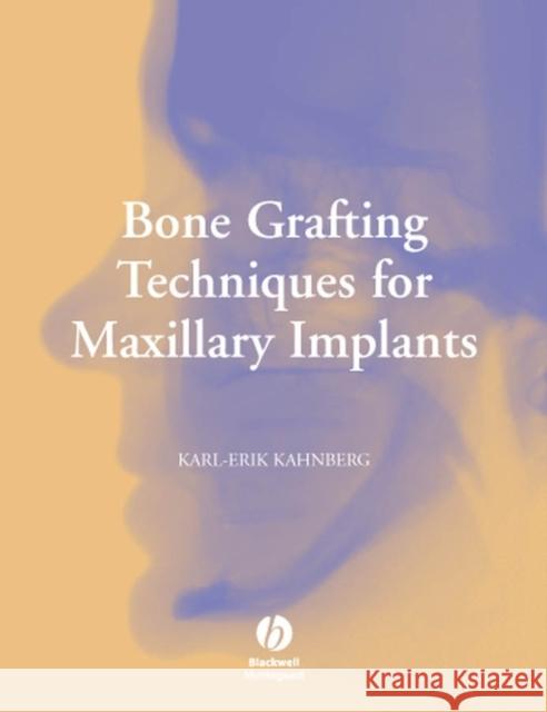 Bone Grafting Techniques for Maxillary Implants Karl-Erik Kahnberg Lars Rasmusson Goran Zellin 9781405129947 Blackwell Publishers