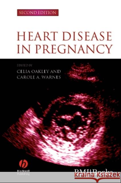 Heart Disease in Pregnancy Oakley                                   Celia Oakley Carole A. Warnes 9781405134880 Blackwell Publishers