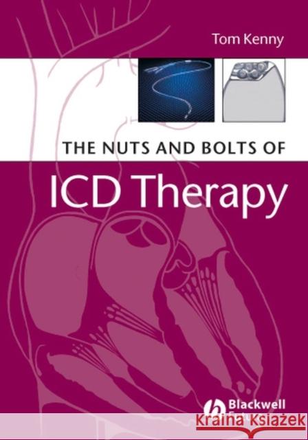 The Nuts and Bolts of ICD Therapy Tom Kenny 9781405135115 Blackwell/Futura