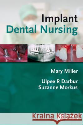 Implant Dental Nursing Mary Miller Ulpee R. Darbar Suzanne Morkus 9781405144285 