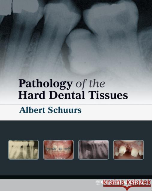Pathology of the Hard Dental T Schuurs, Albert 9781405153652 Wiley-Blackwell