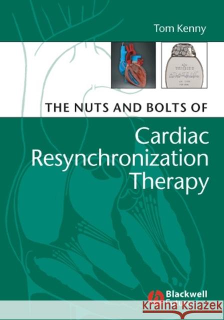 Nuts and Bolts of Cardiac Kenny, Tom 9781405153720 John Wiley and Sons Ltd