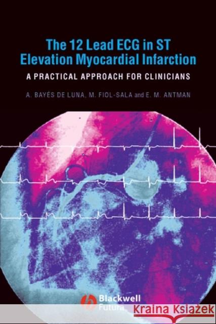 The 12-Lead ECG in ST Elevation Myocardial Infarction: A Practical Approach for Clinicians Bayés de Luna, Antoni 9781405157865 Blackwell Publishers