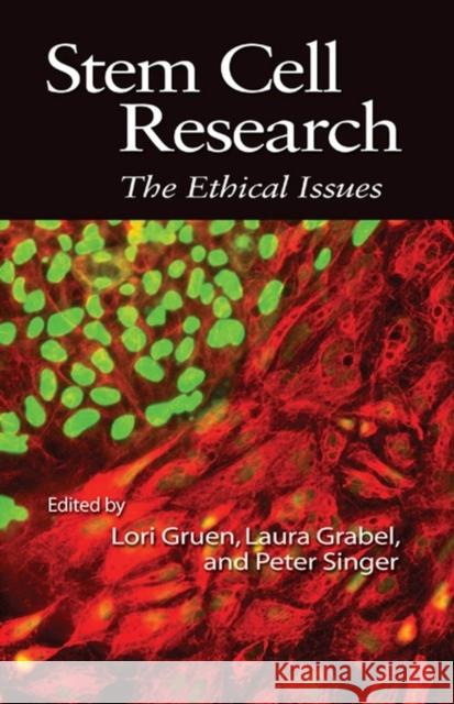 Stem Cell Research: The Ethical Issues Gruen, Lori 9781405160629