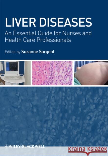 Liver Diseases: An Essential Guide for Nurses and Health Care Professionals Sargent, Suzanne 9781405163064 0