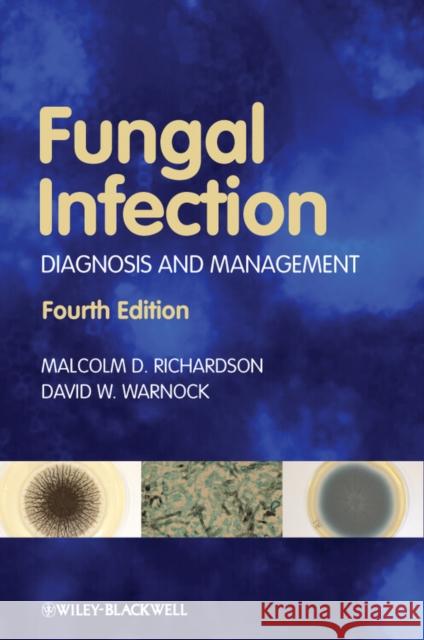 Fungal Infection 4e Richardson, Malcolm D. 9781405170567 John Wiley & Sons