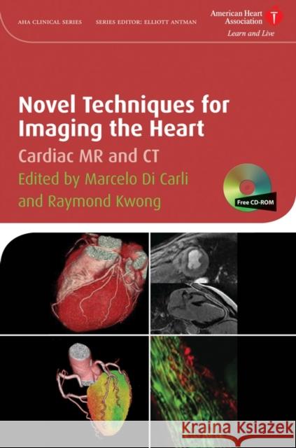 Novel Techniques for Imaging the Heart: Cardiac MR and CT [With CDROM] Di Carli, Marcelo F. 9781405175333 Wiley-Blackwell