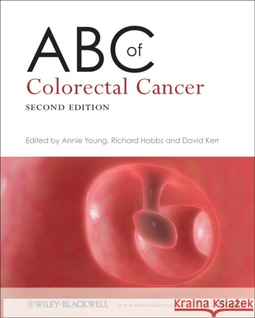 ABC of Colorectal Cancer Annie Young 9781405177634