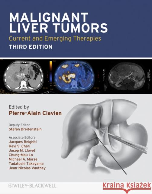 Malignant Liver Tumors: Current and Emerging Therapies Clavien, Pierre-Alain 9781405179768