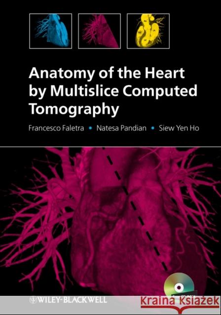 anatomy of the heart by multislice computed tomography  Faletra, Francesco 9781405180559