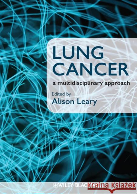 Lung Cancer: A Multidisciplinary Approach Leary, Alison 9781405180757