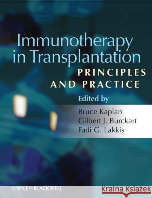 Immunotherapy in Transplantation: Principles and Practice Kaplan, Bruce 9781405182713 Wiley-Blackwell