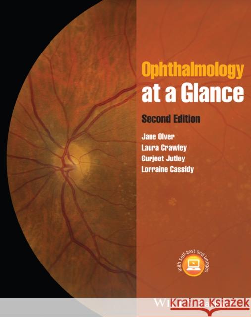 Ophthalmology at a Glance Olver, Jane 9781405184731 John Wiley & Sons