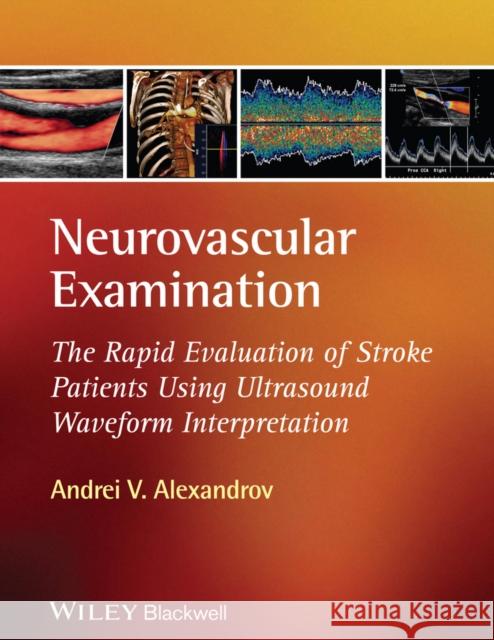 Neurovascular Examination: The Rapid Evaluation of Stroke Patients Using Ultrasound Waveform Interpretation Alexandrov, Andrei V. 9781405185301 Wiley-Blackwell