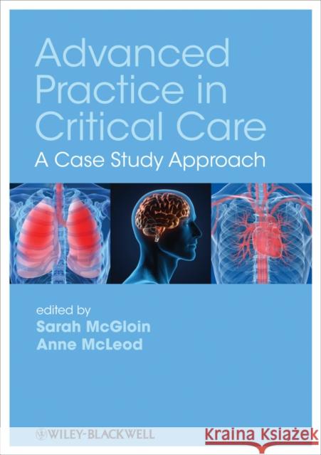 Advanced Practice in Critical Care: A Case Study Approach McGloin, Sarah 9781405185653 0