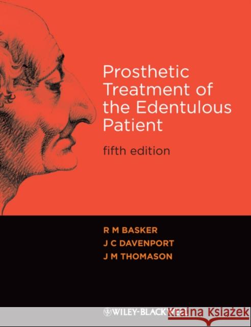 Prosthetic Treatment 5e Basker, R. M. 9781405192613 0
