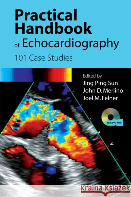 Practical Handbook of Echocardiography: 101 Case Studies Sun, Jing Ping 9781405195560 