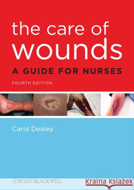 Care of Wounds 4e Dealey, Carol 9781405195690 0