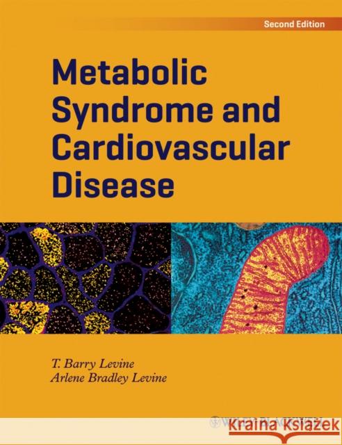 Metabolic Syndrome and Cardiovascular Disease T. Barry Levine Arlene Bradle 9781405195751 Wiley-Blackwell