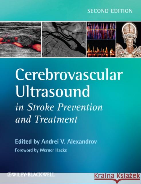 Cerebrovascular Ultrasound in Stroke Prevention and Treatment Alexandrov 9781405195768