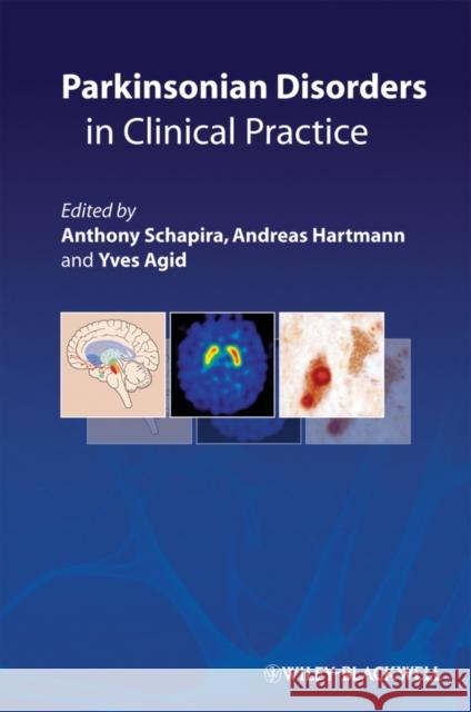 Parkinsonian Disorders in Clinical Practice Anthony Schapira Andreas Hartmann Yves Agid 9781405196017 Wiley-Blackwell