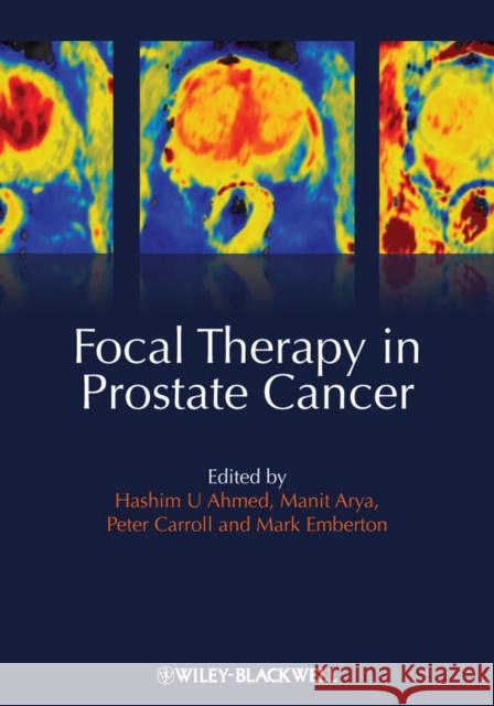 Focal Therapy in Prostate Cancer Manit Arya Mark Emberton Peter R. Carroll 9781405196499 