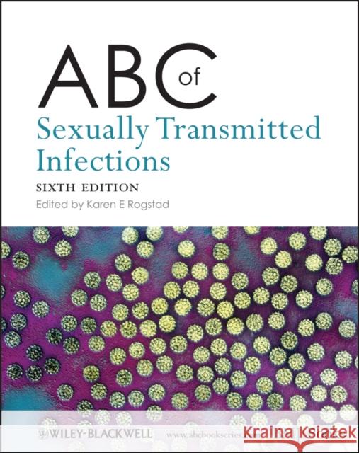 ABC of Sexually Transmitted Infections Karen Rogstad 9781405198165