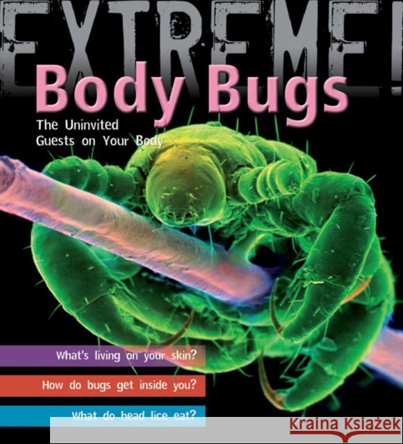 Extreme Science: Body Bugs!: The Uninvited Guests on Your Body Trevor Day 9781408100936 Bloomsbury Publishing PLC
