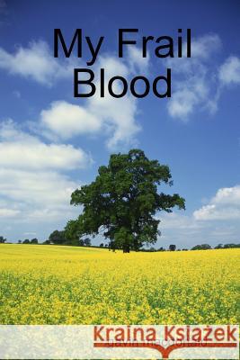 My Frail Blood Gavin Macdonald 9781409201366 