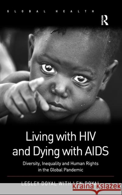 Living with HIV and Dying with AIDS: Diversity, Inequality, and Human Rights in the Global Pandemic Doyal, Lesley 9781409431107 Global Health
