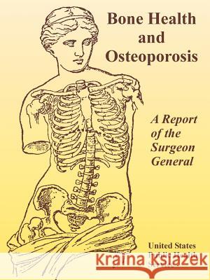 Bone Health and Osteoporosis: A Report of the Surgeon General United States Public Health Service, Surgeon General of the United States 9781410219275 University Press of the Pacific