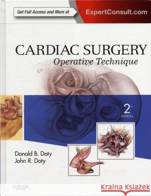 Cardiac Surgery: Operative Technique - Expert Consult: Online and Print Doty, Donald B. 9781416036531 SAUNDERS