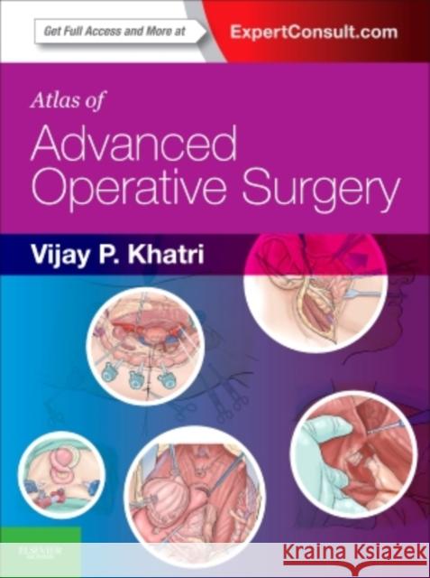 Atlas of Advanced Operative Surgery: Expert Consult - Online and Print Khatri, Vijay P. 9781416041092 W.B. Saunders Company