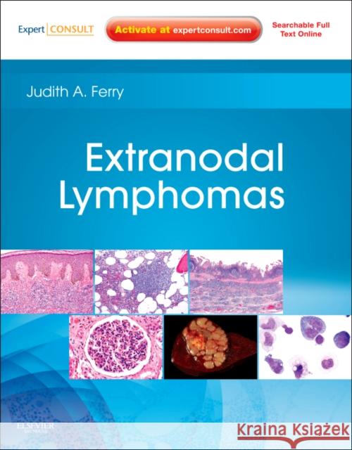 Extranodal Lymphomas: Expert Consult - Online and Print Ferry, Judith A. 9781416045793 0
