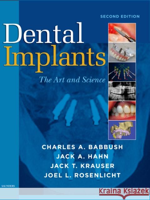 Dental Implants: The Art and Science Babbush, Charles A. 9781416053415 W.B. Saunders Company