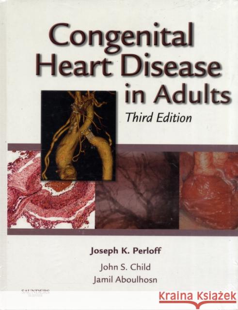 Congenital Heart Disease in Adults Joseph Perloff 9781416058946