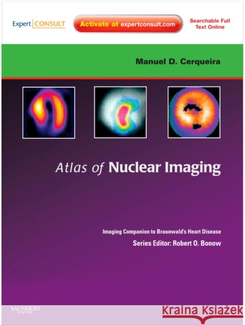 Atlas of Nuclear Cardiology: Imaging Companion to Braunwald's Heart Disease: Expert Consult - Online and Print Iskandrian, Ami E. 9781416061342