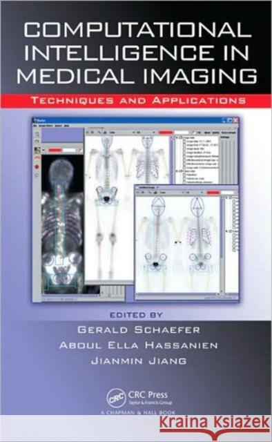 Computational Intelligence in Medical Imaging: Techniques and Applications Schaefer, G. 9781420060591 Chapman & Hall/CRC