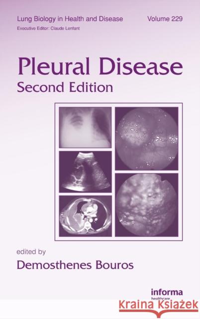 Pleural Disease Demosthenes Bouros 9781420077384 Informa Healthcare