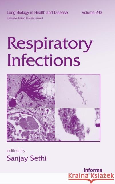 Respiratory Infections Sanjay Sethi 9781420080346 Informa Healthcare