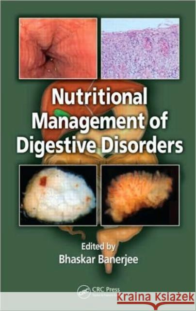 Nutritional Management of Digestive Disorders Bhaskar Banerjee   9781420086546 Taylor & Francis