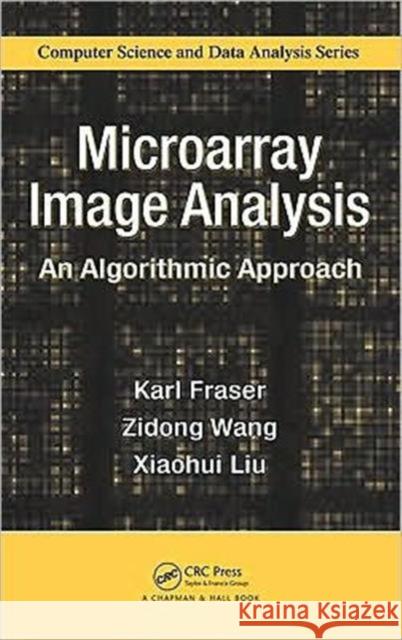 Microarray Image Analysis: An Algorithmic Approach Fraser, Karl 9781420091533 Chapman & Hall/CRC