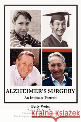 Alzheimer's Surgery: An Intimate Portrait Weiss, Betty 9781420857955 Authorhouse