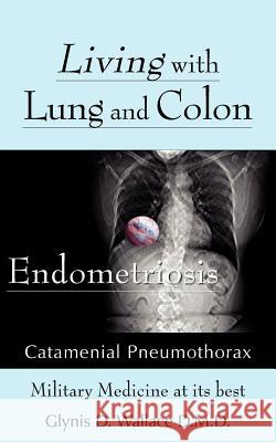 Living With Lung and Colon Endometriosis: Catamenial Pneumothorax Wallace, Glynis D. 9781420883312 Authorhouse