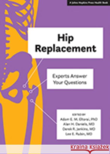 Hip Replacement: Experts Answer Your Questions Adam E. M. Eltorai Alan H. Daniels Derek R. Jenkins 9781421429588