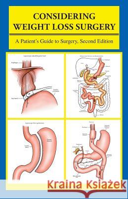 Considering Weight Loss Surgery: A Patient's Guide to Surgery, Second Edition Ihde MD, Glenn M. 9781426905056 Trafford Publishing