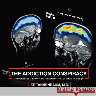 The Addiction Conspiracy: Unlocking Brain Chemistry and Addiction so You Don't Have to Struggle Tannenbaum, Lee 9781434366481 Authorhouse