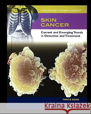 Skin Cancer: Current and Emerging Trends in Detection and Treatment Tracie Egan 9781435837447 Rosen Central