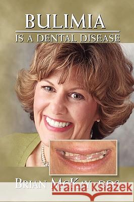 Bulimia Is a Dental Disease Brian Dds McKay 9781436352215 Xlibris Corporation