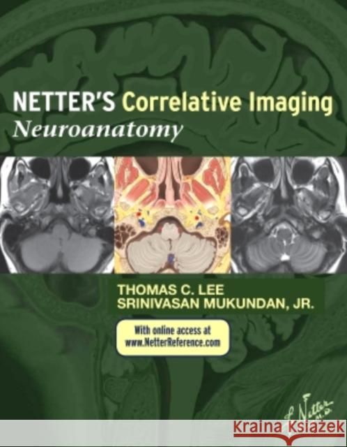 Netter's Correlative Imaging: Neuroanatomy with Access Code Lee, Thomas C. 9781437704150 Elsevier Saunders
